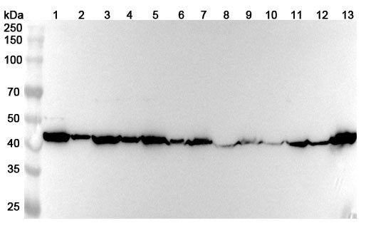 Western blot analysis was performed using anti-PSMC6 polyclonal antibody at 1ug/mL on various samples.
Lane 1: 293T cell lysate
Lane 2: SH-SY5Y cell lysate
Lane 3: NCI-H460 cell lysate
Lane 4: Hela cell lysate
Lane 5: HepG2 cell lysate
Lane 6: Mouse brain lysate
Lane 7: Mouse liver lysate
Lane 8: Mouse spleen lysate
Lane 9: Mouse kidney lysate
Lane 10: Rat brain lysate
Lane11: Rat liver lysate
Lane12: Rat spleen lysate
Lane13: Rat kidney lysate
