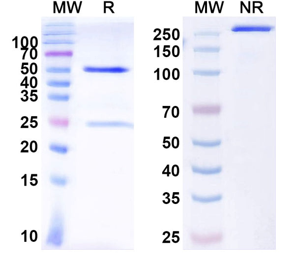SDS-PAGE for Anti-ARHGAP4 Antibody (N290B/25)
