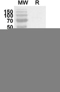 Western blot analysis was performed using anti-CRADD polyclonal antibody at 1ug/mL on recombinant CRADD (Catalog No. HX957012).