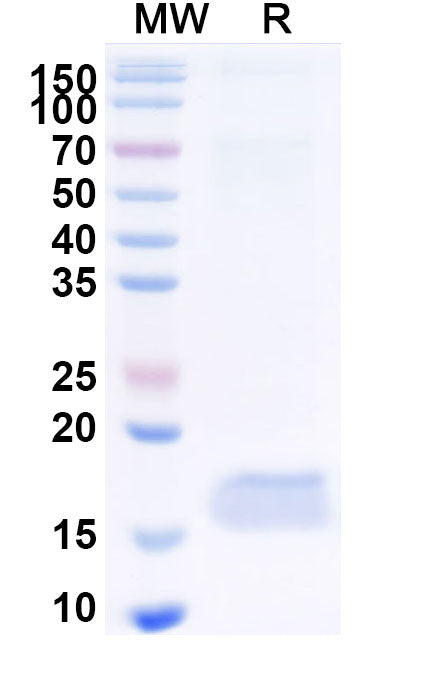 SDS-PAGE for Anti-Human CD269/TNFRSF17/BCMA Nanobody (SAA1321)