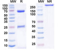 SDS-PAGE for Anti-Human DSG1/3 Antibody (SAA0841)
