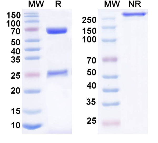 SDS-PAGE for Anti-Human DSG1/3 Antibody (SAA0841)