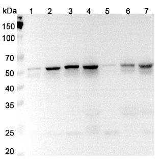 Western blot analysis was performed using anti-FLI1 polyclonal antibody at 1μg/ml on various samples.
Lane 1: HL60 cell lysate
Lane 2: Jurkat cell lysate
Lane 3: U937 cell lysate
Lane 4: RAW264.7 cell lysate
Lane 5: K562 cell lysate
Lane 6: Mouse thymus lysate
Lane 7: Mouse lung lysate