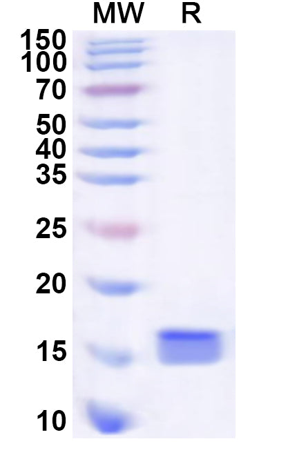 Recombinant Human CENPC Protein, N-His
