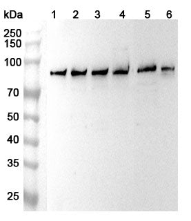 Western blot analysis was performed using anti-SH3BP2 polyclonal antibody at 1ug/mL on various samples.
Lane 1: Hela cell lysate
Lane 2: PC-3 cell lysate
Lane 3: Jurkat cell lysate
Lane 4: HepG2 cell lysate
Lane 5: Raji cell lysate
Lane 6: A431 cell lysate