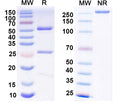 SDS-PAGE for Anti-GST Antibody (N100/13)