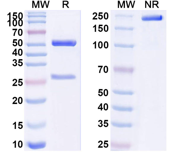 SDS-PAGE for Anti-Human BCR Antibody (SAA1570)