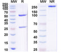 SDS-PAGE for Anti-Human CALCA Antibody (SAA2004).