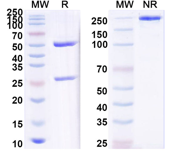 SDS-PAGE for Anti-Human CALCA Antibody (SAA2004).