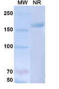 Anti-Human CGRP1 Reference Antibody (Galcanezumab) – Figure 1 of 1