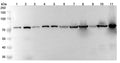 Western blot analysis was performed using anti-ANXA6 polyclonal antibody at 1μg/ml on various samples.
Lane 1: Jurkat cell lysate
Lane 2: Hela cell lysate
Lane 3: A549 cell lysate
Lane 4: C2C12 cell lysate
Lane 5: PC12 cell lysate
Lane 6: Mouse kidney lysate
Lane 7: Mouse heart lysate
Lane 8: Mouse liver lysate
Lane 9: Rat kidney lysate
Lane 10: Rat heart lysate