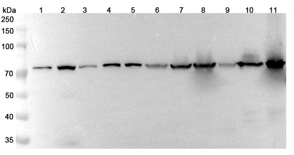 Western blot analysis was performed using anti-ANXA6 polyclonal antibody at 1μg/ml on various samples.
Lane 1: Jurkat cell lysate
Lane 2: Hela cell lysate
Lane 3: A549 cell lysate
Lane 4: C2C12 cell lysate
Lane 5: PC12 cell lysate
Lane 6: Mouse kidney lysate
Lane 7: Mouse heart lysate
Lane 8: Mouse liver lysate
Lane 9: Rat kidney lysate
Lane 10: Rat heart lysate