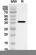 Western blot analysis was performed using anti-C9 polyclonal antibody at 1ug/mL on recombinant C9 (Catalog No. HY033012).