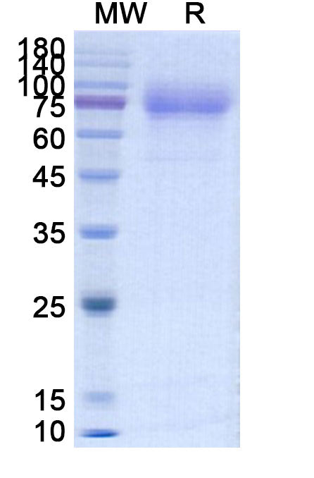 Recombinant Human CD115/CSF1R Protein, C-His