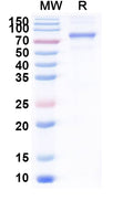 Recombinant Human CD71/TFRC Protein, C-His