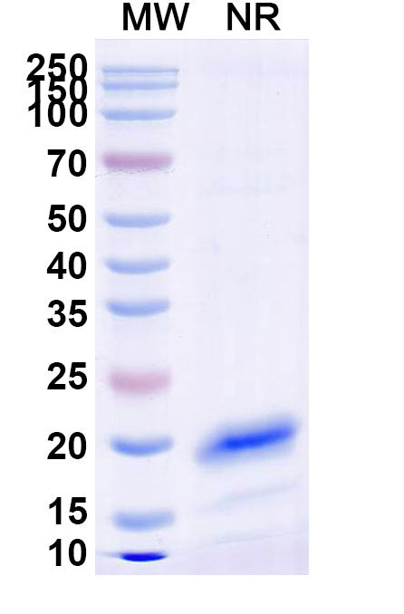 SDS-PAGE for Anti-Human CD71/TFRC Nanobody (SAA1205)