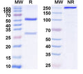 Anti-Human CD71/TFRC Reference Antibody (AbGn-107) – Figure 1 of 1