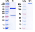 SDS-PAGE for Anti-Human CD14 Monoclonal Antibody (1A156)
