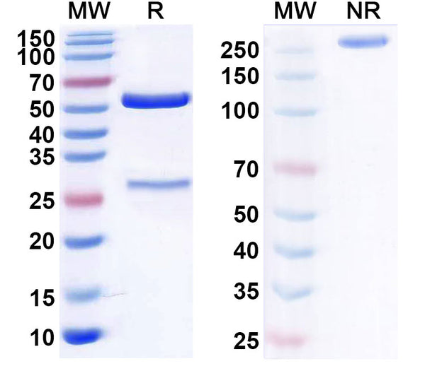 SDS-PAGE for Anti-Human CD14 Monoclonal Antibody (1A156)