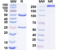 SDS-PAGE for Anti-Human TP53/p53 (R175H mutant) Antibody (F2)