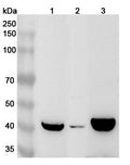 Western blot analysis was performed using anti-ABHD2 polyclonal antibody at 1ug/mL on various samples.
Lane 1: Mouse heart lysate
Lane 2: Mouse lung lysate
Lane 3: Rat heart lysate
