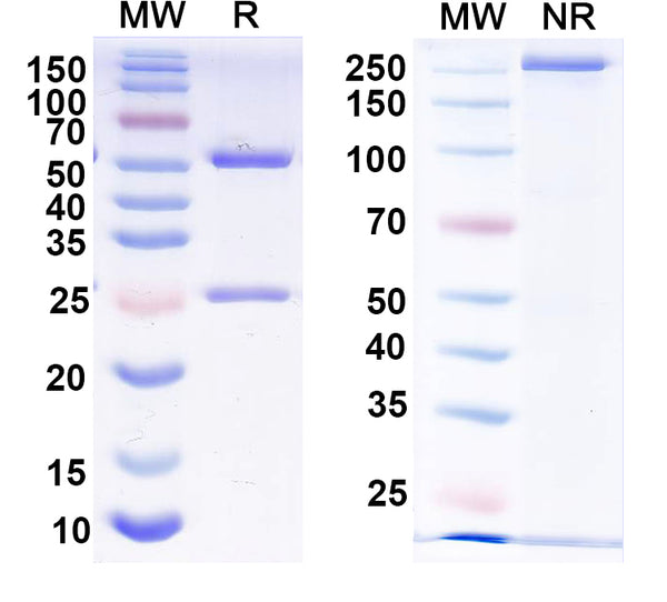 SDS-PAGE for Anti-Thyroid hormone receptor beta 1 Antibody (N402/26)