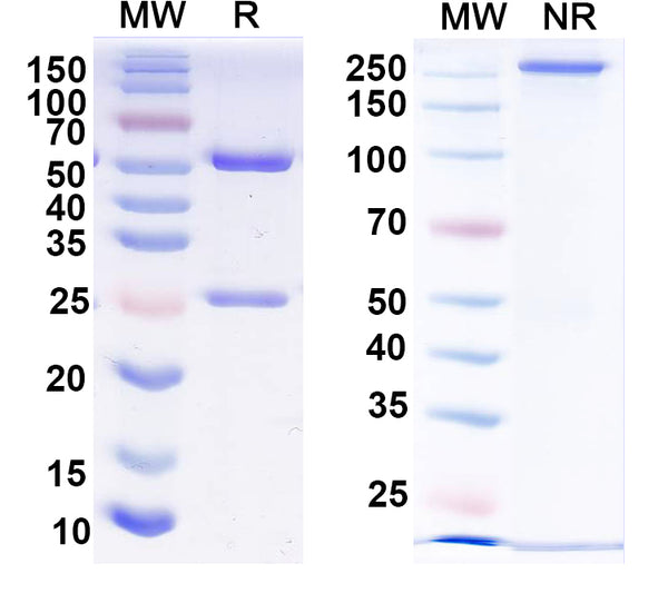 SDS-PAGE for Anti-Thyroid hormone receptor beta 2 Antibody (N404/30)