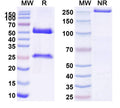SDS-PAGE for Anti-Human SHBG Monoclonal Antibody (1A382)