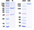 SDS-PAGE for Anti-Gs protein, alpha subunit Antibody (N192/12)