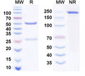 Anti-Human Integrin AVB6 (ITGAV & ITGB6) Reference Antibody (STX-100) – Figure 1 of 2