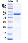 Recombinant Human CNP Protein, N-His