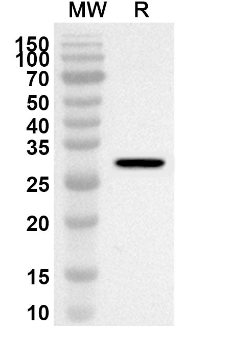 Western blot analysis was performed using anti-PYGB polyclonal antibody at 1ug/mL on recombinant PYGB (Catalog No. HY073012).