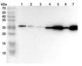 Western blot analysis was performed using anti-MGST1 polyclonal antibody at 1ug/mL on various samples.
Lane 1: K562 cell lysate
Lane 2: Siha cell lysate
Lane 3: Hela cell lysate
Lane 4: Mouse liver lysate
Lane 5: Mouse lung lysate
Lane 6: Rat liver lysate
Lane 7: Rat lung lysate