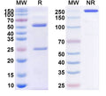 SDS-PAGE for Anti-Human AMH Monoclonal Antibody (1A123)