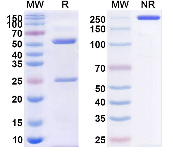 SDS-PAGE for Anti-Human AMH Monoclonal Antibody (1A123)
