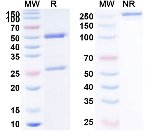 SDS-PAGE for Anti-Human AMH Monoclonal Antibody (1A124)