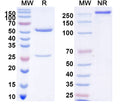 SDS-PAGE for Anti-Human AMH Monoclonal Antibody (1A375)