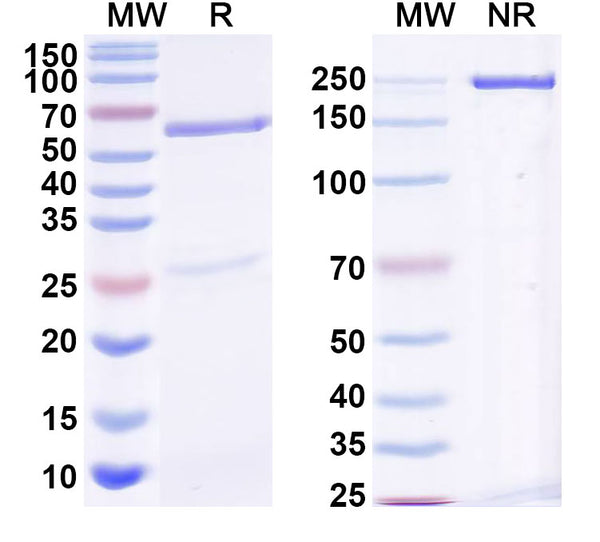 SDS-PAGE for Anti-Human AMH Monoclonal Antibody (1A376)