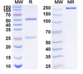 SDS-PAGE for Anti-Human AMH Monoclonal Antibody (1A377)