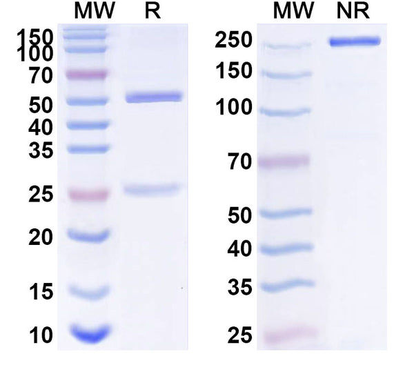 SDS-PAGE for Anti-Human AMH Monoclonal Antibody (1A377)