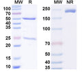 SDS-PAGE for Anti-Phospho-Tau (pT231) Antibody (SAA3.24)