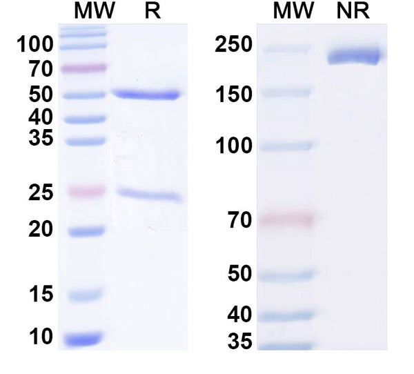 SDS-PAGE for Anti-Phospho-Tau (pT231) Antibody (SAA3.24)