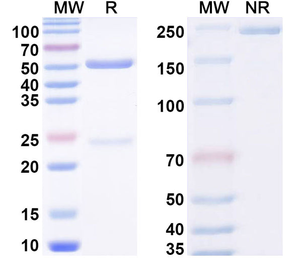 SDS-PAGE for Anti-Phospho-Tau (pT212/pS214) Antibody (SAA0292)