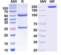 SDS-PAGE for Anti-Human MAPT/Tau/PHF-tau Antibody (RB86)