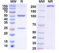 SDS-PAGE for Anti-Phospho-Tau (pS396/pS404) Antibody (PHF1)