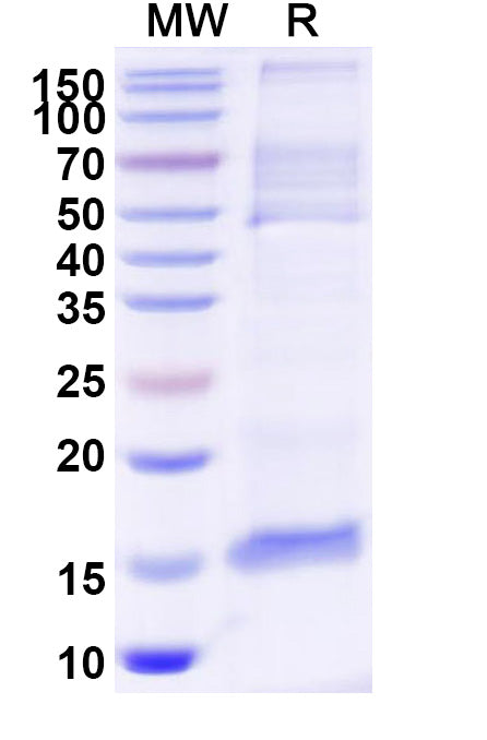 SDS-PAGE for Anti-Human MAPT/Tau/PHF-tau Nanobody (2C5)