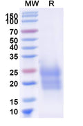 Recombinant Human TDGF1/CRIPTO Protein, C-His