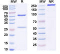Anti-Human Complement C2 Reference Antibody (Empasiprubart) – Figure 1 of 1