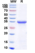 Recombinant Human NTRK1 Protein, N-His