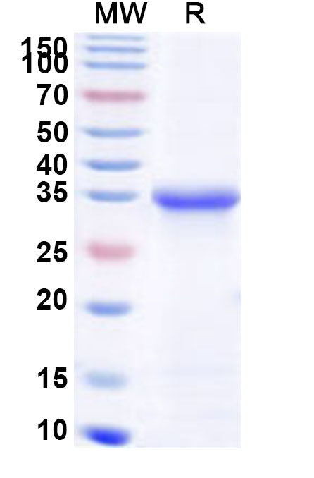 Recombinant Human NTRK1 Protein, N-His